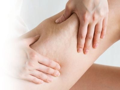 4020c32dd87072c3fafb4b0412cbdda5